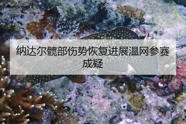 na-da-er-kuan-bu-shang-shi-hui-fu-jin-zhan-wen-wang-can-sai-cheng-yi-2-632.jpg